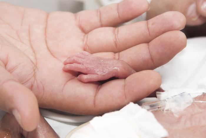 Un invento que ya salvó la vida de más de 150 mil bebes alrededor del mundo -0